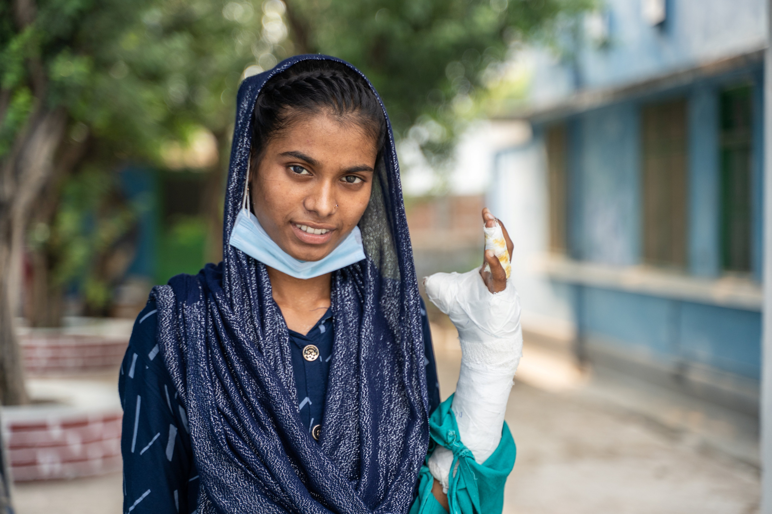 Portretfoto van een jonge vrouw met haar hand in het gips
